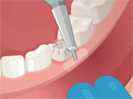 Operate Now: Dental Surgery online game